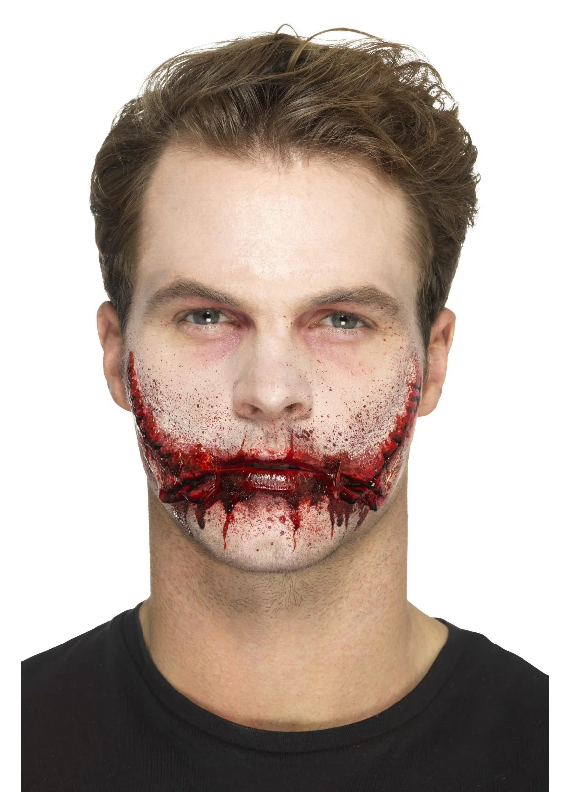 Stitched Smile Prosthetic